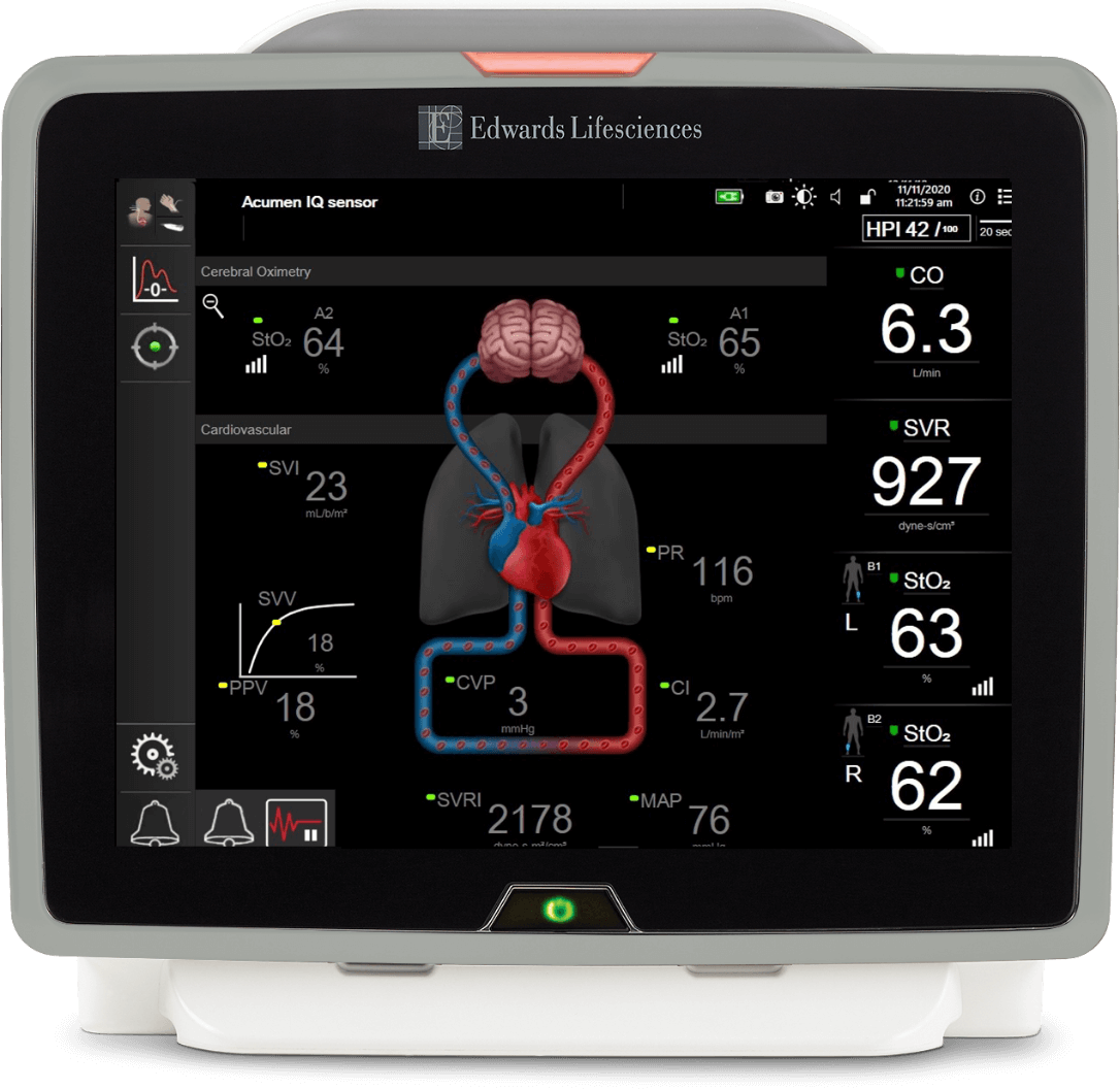 Plataforma de monitorizaci�n avanzada HemoSphere